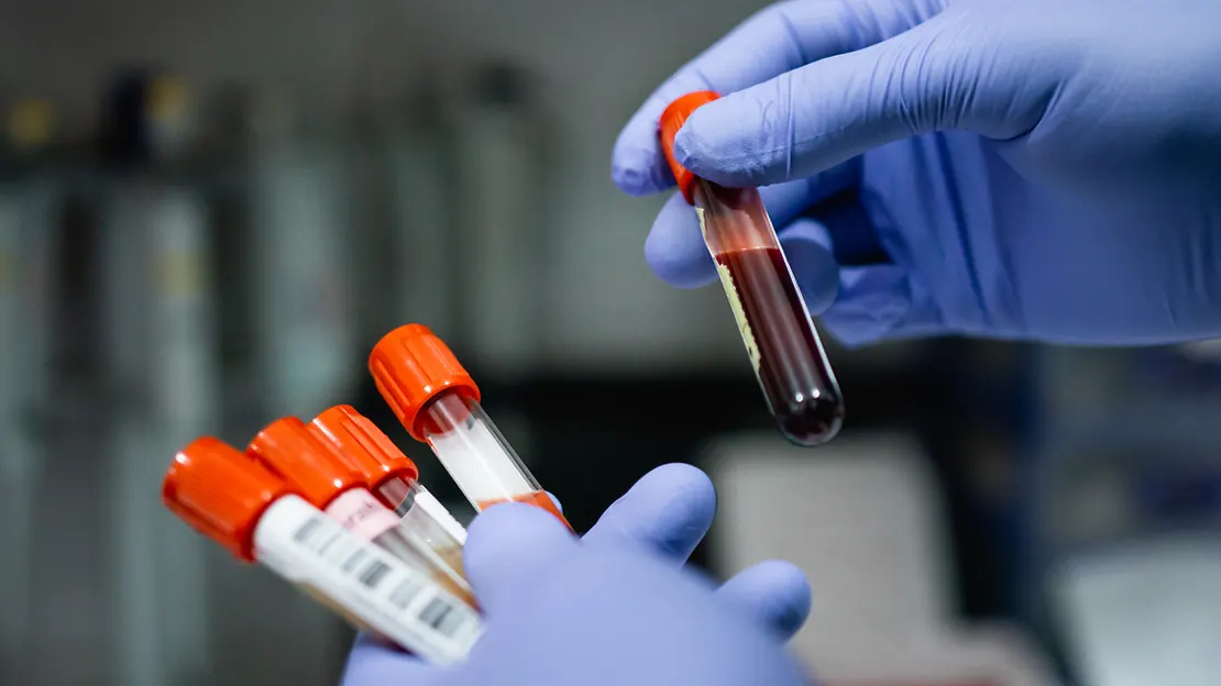 Phlebotomist preparing to draw a blood sample from a patient